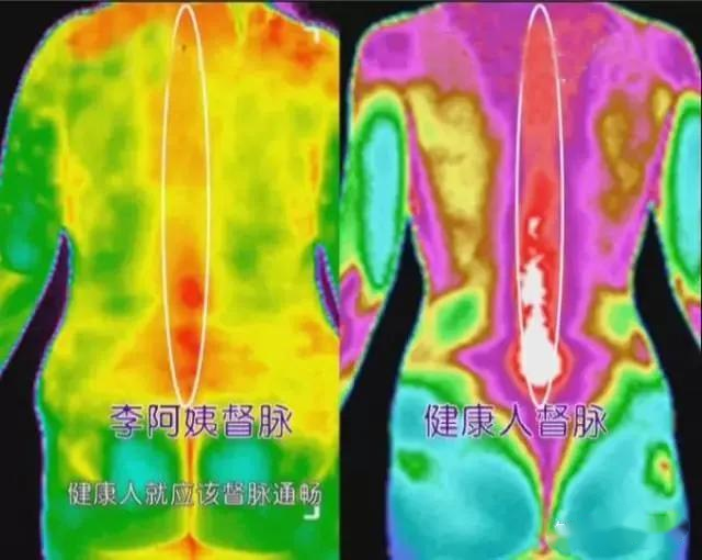 紅外熱成像可以看病？了解一下醫(yī)療診斷應(yīng)用